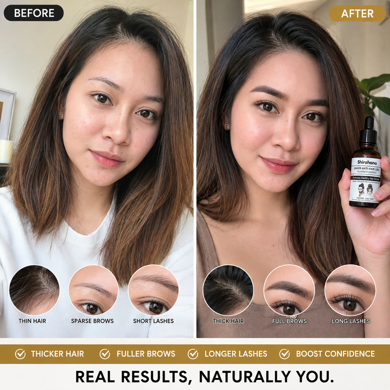 Shirohana Ginger Anti-Hair Loss Treatment Essence