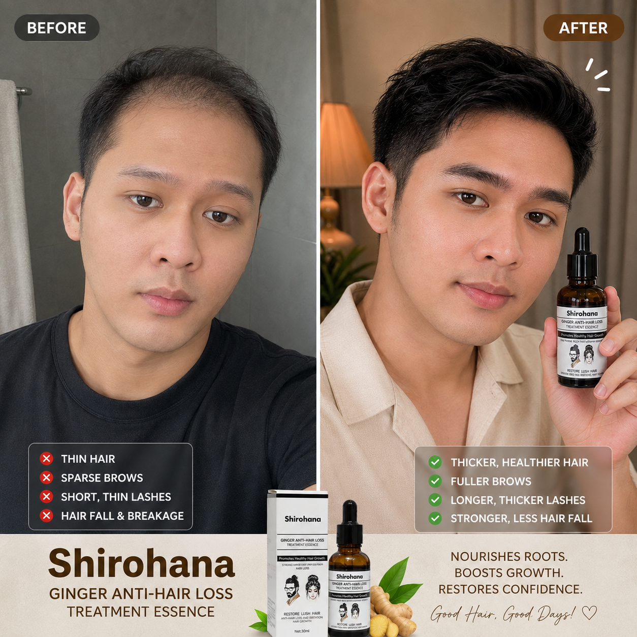 Shirohana Ginger Anti-Hair Loss Treatment Essence
